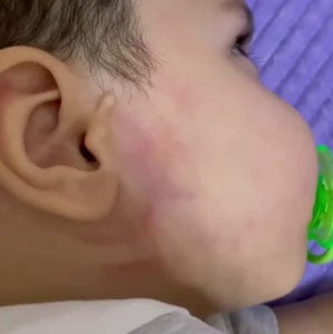 Боғчада калтакланган 1 ёшли гўдак ҳақида ИИБ муносабат билдирди