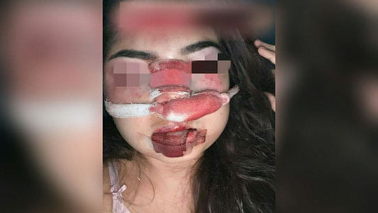 Аёл таҳқирланди! Тошкентда солиқчи хотинини ерга ётқизиб, дўппослади