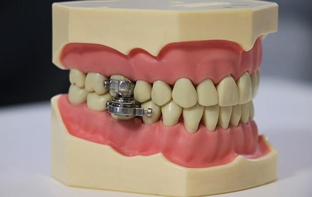 Янги Зеландияда «озишга ёрдам берадиган дунёдаги илк қурилма» яратилди