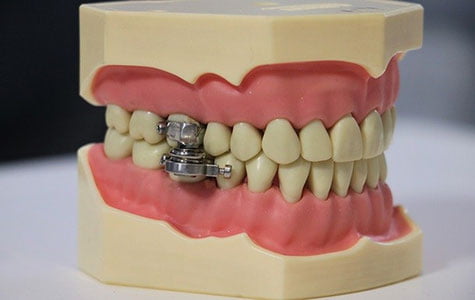 Янги Зеландияда «озишга ёрдам берадиган дунёдаги илк қурилма» яратилди