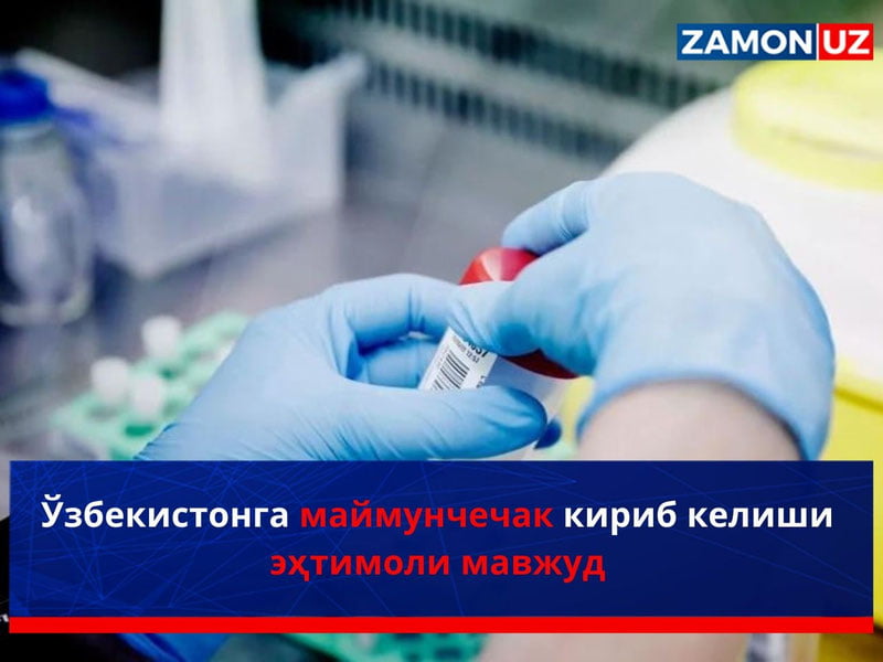 O‘zbekistonga maymunchechak kirib kelishi ehtimoli mavjud