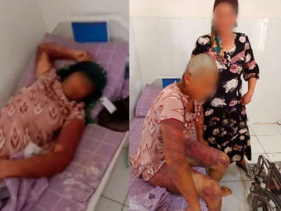 Қашқадарёда келин эри ва унинг яқинлари томонидан "самосуд" қилинди