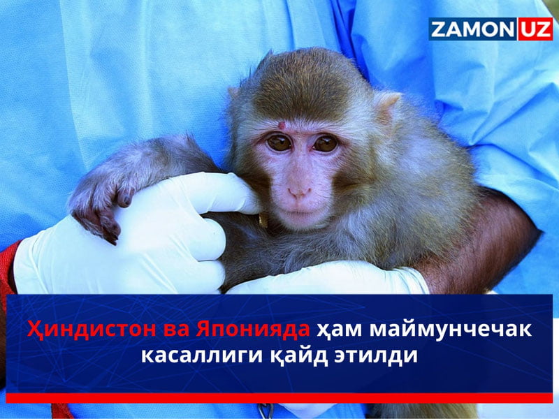 Hindiston va Yaponiyada ham maymunchechak kasalligi qayd etildi
