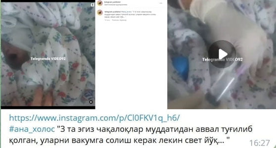 Уч эгизак дунёга келган туғуруқхонада “свет” ўчгани айтилди