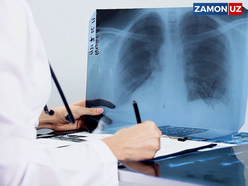 Силдан ўлим кўрсаткичи дунёда 20 йиллик пасайишдан сўнг кескин ошди