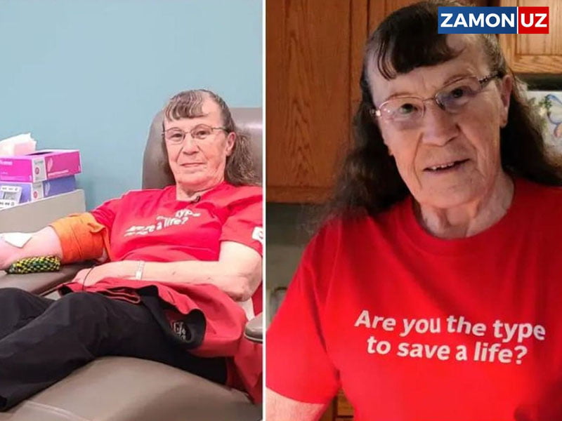 80 ёшли аёл 96 литр қон топширди