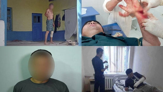 Сурхондарёда фуқаро инспекторни болта билан жароҳатлади