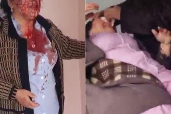 Самарқандда 2 нафар ҳамширани калтаклаган аёлга ҳукми ўқилди