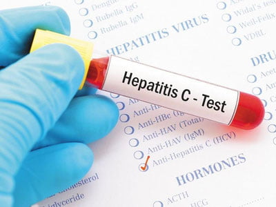 Гепатит С га чалинган беморлар учун яна cалкам 7000 дона дори воситалари олиб келинди