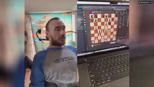 Miyasiga chip o‘rnatilgan bemor fikrlash kuchi bilan shaxmat o‘ynadi