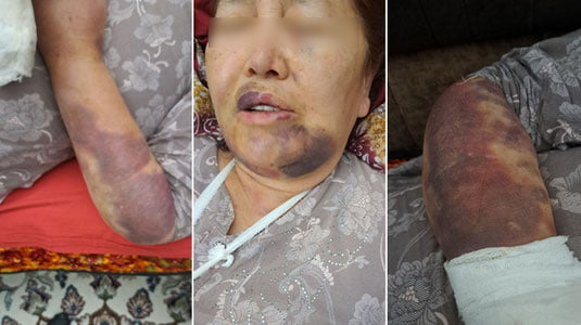 Toshkentda hokim yordamchisi onasini kaltakladi