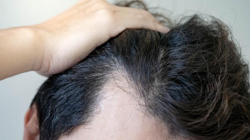 Soch to‘kilishiga qarshi yangi vosita topildi