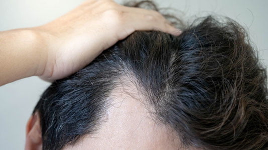 Soch to‘kilishiga qarshi yangi vosita topildi