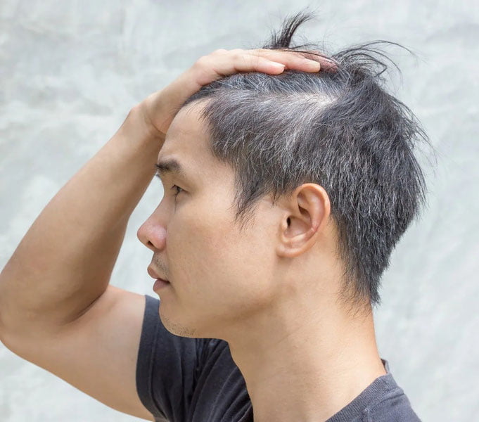 Сочга эрта оқ тушишининг сабаби нимада?