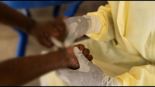 Эронда маймунчечак аниқланди