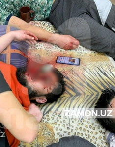 Россияда ўзбекистонлик фуқаролар номаълум моддадан заҳарланди