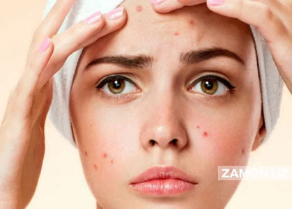 Husnbuzarlar sizga noqulayliklar keltirayotgan bo‘lsa, o‘zingizga bo‘lgan munosabatni o‘zgartiring