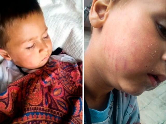 Навоийдаги боғчада бола калтакланди