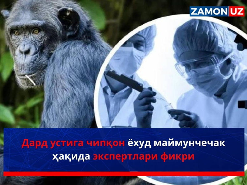 Дард устига чипқон ёхуд маймунчечак ҳақида экспертлари фикри