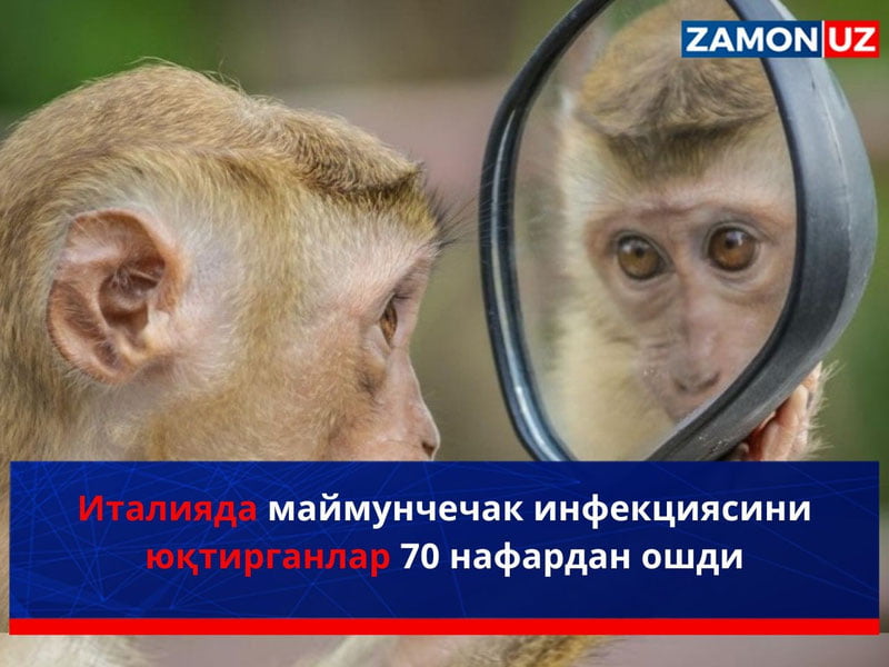 Italiyada maymunchechak infeksiyasini yuqtirganlar 70 nafardan oshdi
