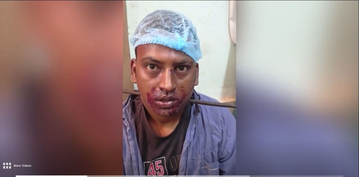 Бўйнига темир найза кириб кетган бемор ўз оёғи билан шифохонага келди