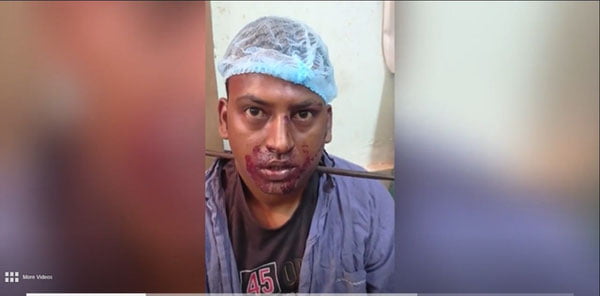 Бўйнига темир найза кириб кетган бемор ўз оёғи билан шифохонага келди