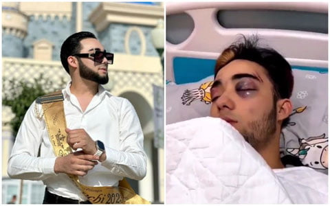 20 yoshli bloger operatsiya vaqtida vafot etdi