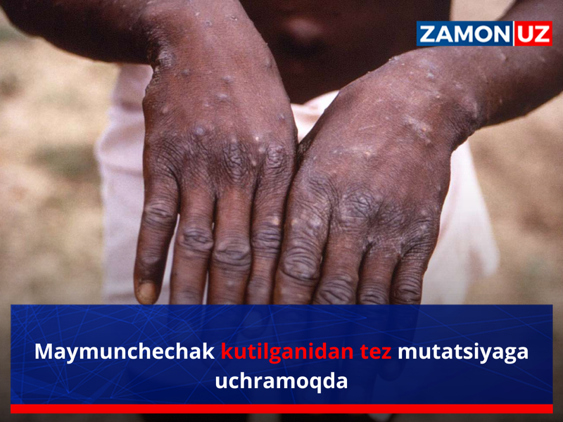 Maymunchechak kutilganidan tez mutatsiyaga uchramoqda