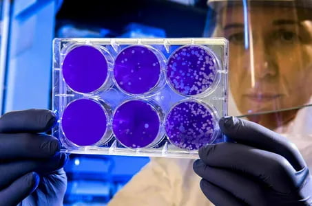 СОВИД-19 янги штаммлари пайдо бўлиши мумкин—ЖССТ