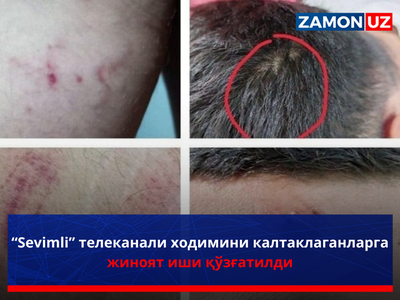 “Sevimli” telekanali xodimini kaltaklaganlarga jinoyat ishi qo‘zg‘atildi