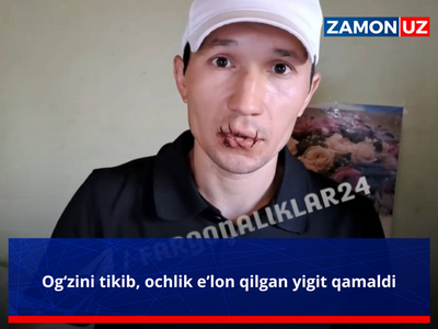 Оғзини тикиб, очлик эълон қилган йигит қамалди