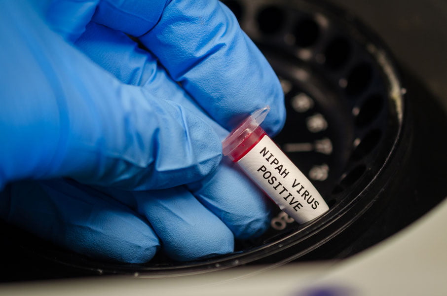 Диққат, Nipah вируси!