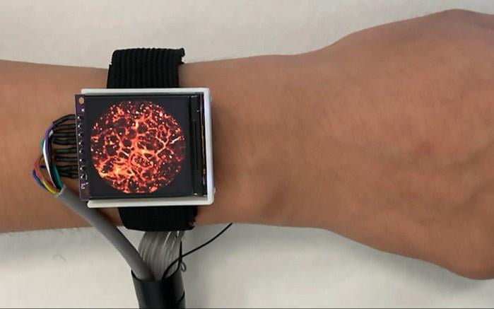 Qon tomirlari ichini ko‘rish imkonini beruvchi sensor yaratildi