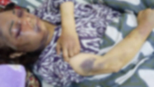 Жиззахда келин қайнонасини аёвсиз калтаклади