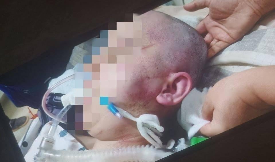 Oqqo‘rg‘onda eri kaltaklagan ayol vafot etdi