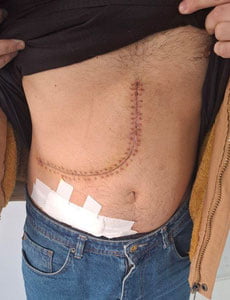 Инсон органлари савдоси билан шуғулланган уюшган гуруҳ қўлга олинди