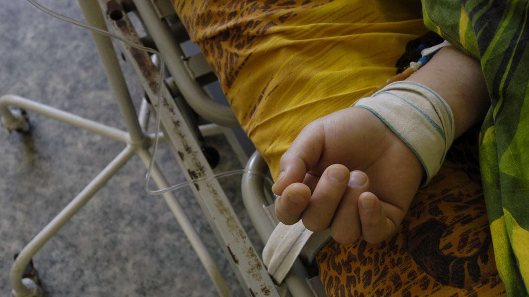 Toshkent viloyatidagi shifoxonalarda qancha bola davolanayotgani aytildi