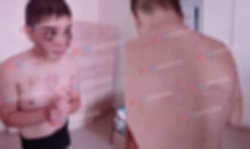 Toshkentda nogironligi bo‘lgan bola ayovsiz kaltaklandi