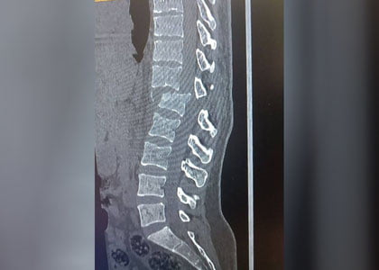 Navoiyda er xotinini qasddan avtomobil bilan urib, falaj qildi