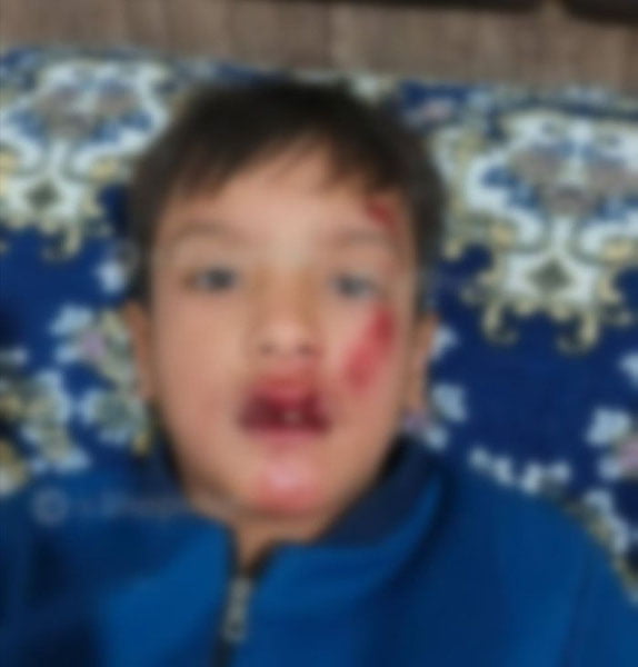 Тошкентда 9-синф ўқувчиси 3-синф ўқувчисини калтаклагани айтилмоқда