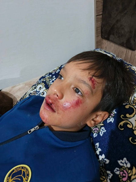 9-синф ўқувчиси 3-синф ўқувчисини калтаклагани юзасидан расмий муносабат билдирилди