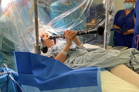 Londonda ayol miya operatsiyasi vaqtida musiqa chaldi